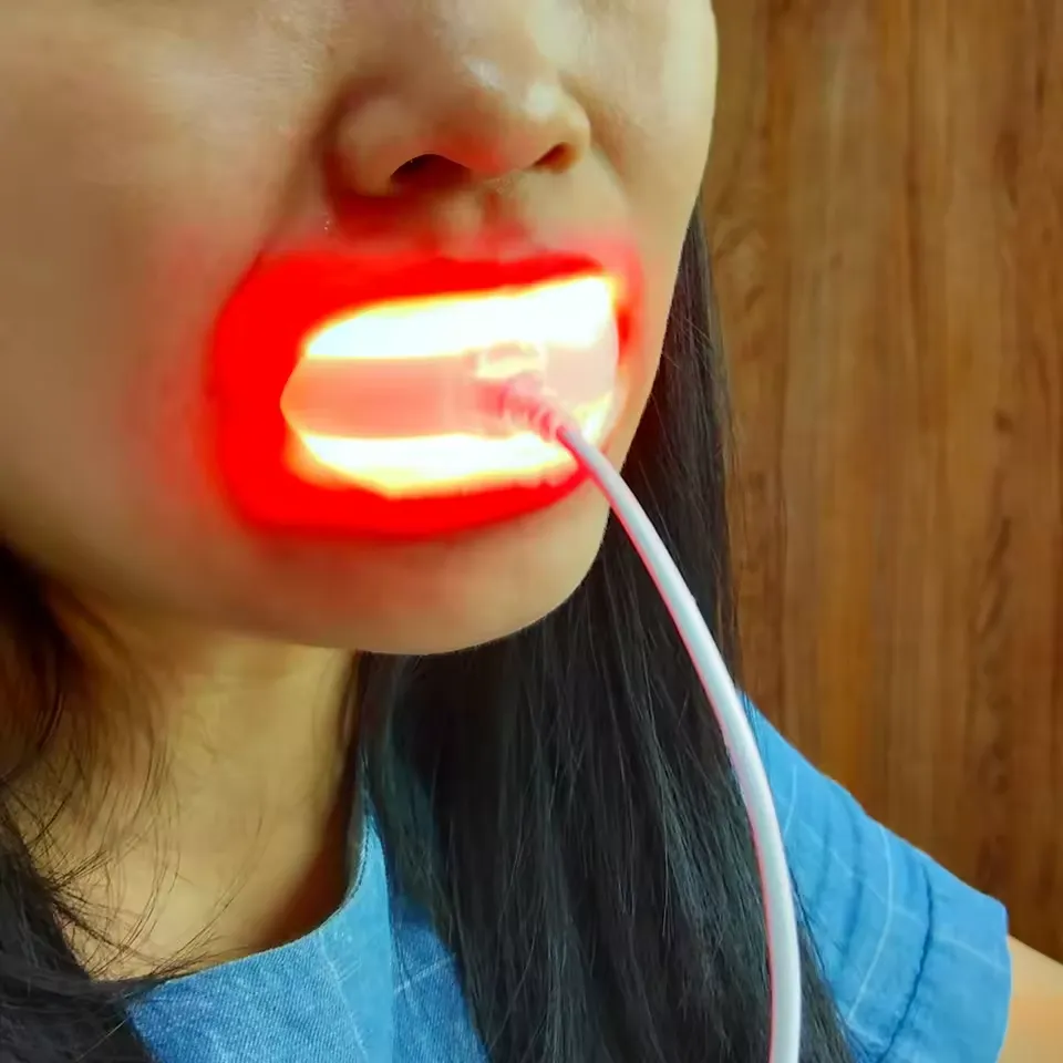 Aura Shield Dual-Light Oral Therapy & Whitening System - Image 2