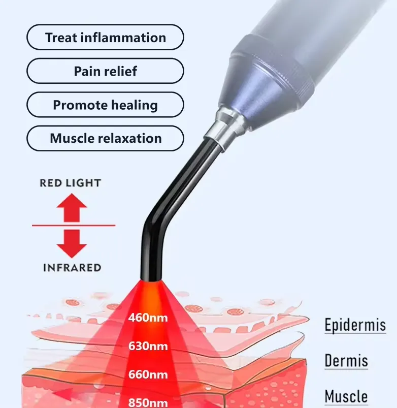 Cold Sore 5-Wavelength Red Light Therapy Wand - Image 4