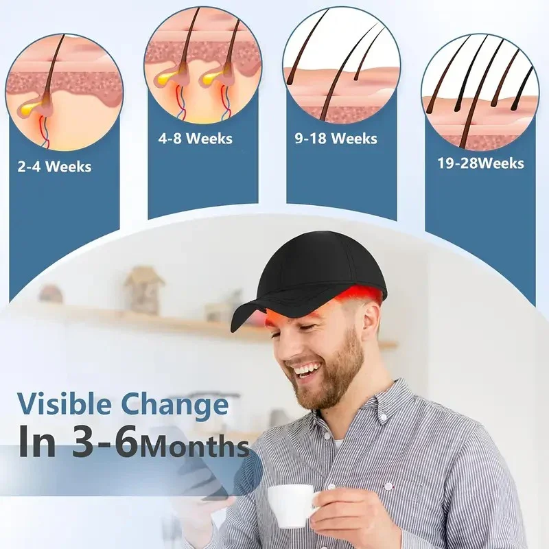 Korean Red Light Hair Growth Cap - Image 3