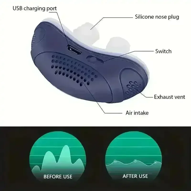 QC Magic Anti Snoring Device - Image 7