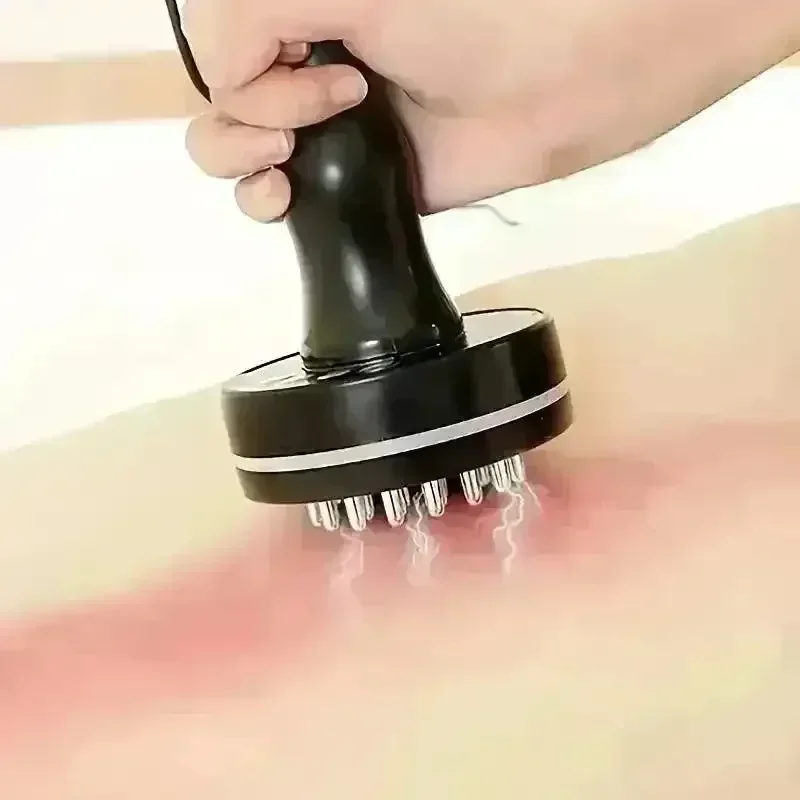 Smart Electric Cupping Massager - Image 5