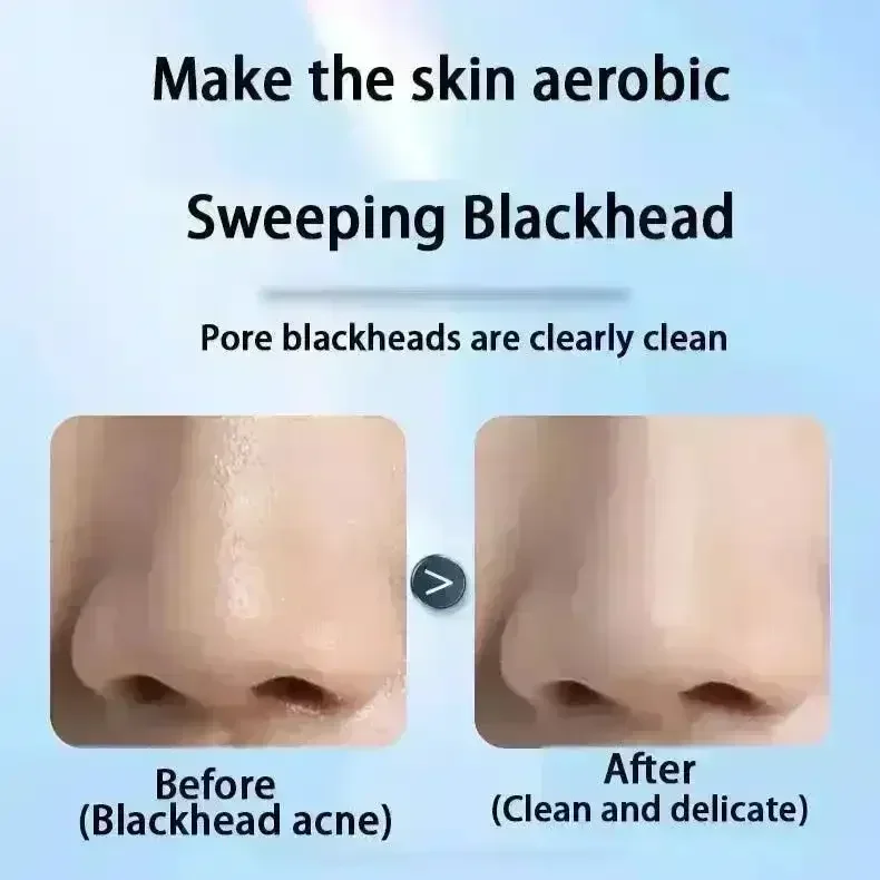 Visualized 50X Blackhead Absorber - Image 2